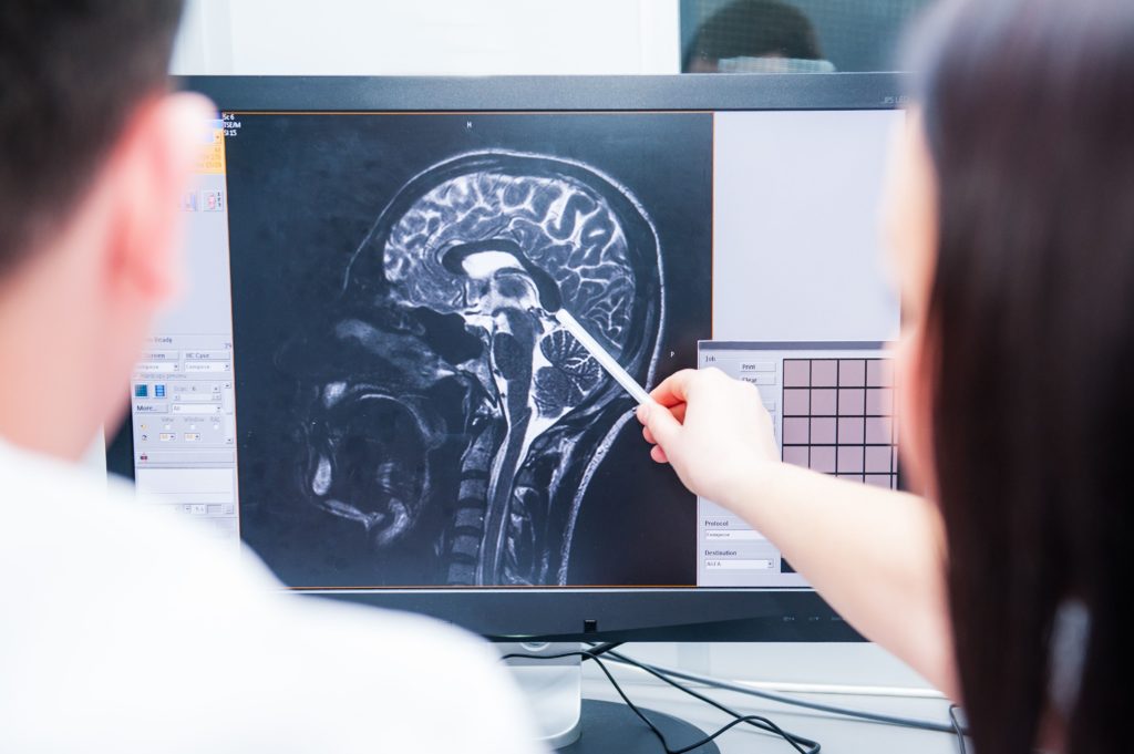 Doctors looking at a head scan